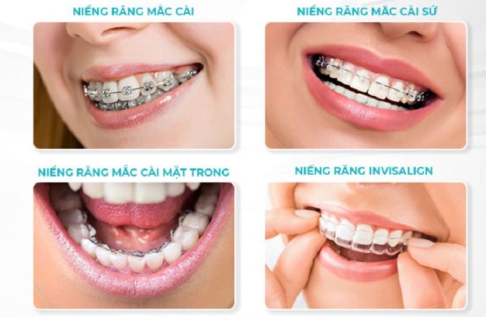cac dich vu nha khoa chat luong cao 3 700x458